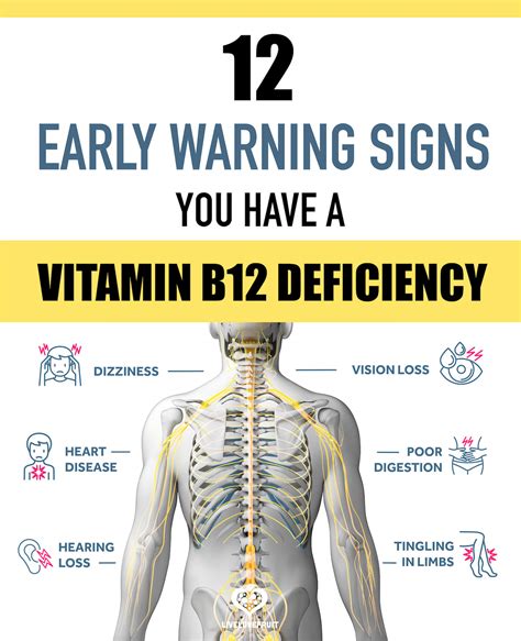 Vitamin B12 Deficiency | ExpertsGuys