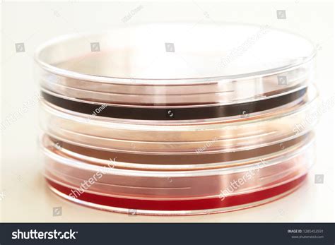 Close Various Agar Plates On White Stock Photo 1285453591 | Shutterstock