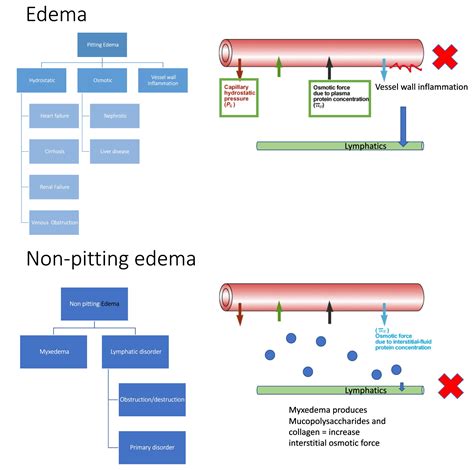 Pitting Edema Non Pitting Edema