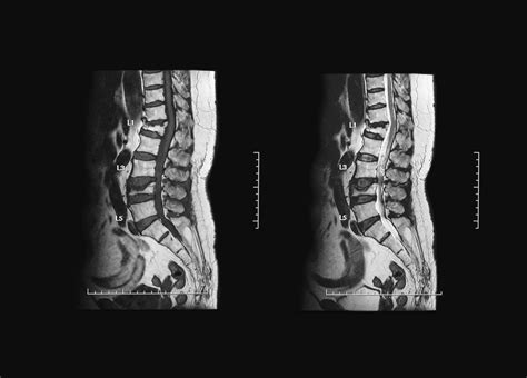 What is MRI Contrast? | GE Healthcare (United States)