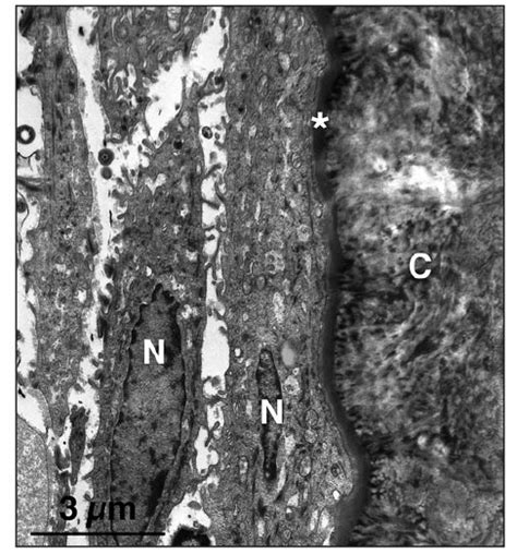 Transmission electron micrograph illustrating the basal lamina,... | Download Scientific Diagram