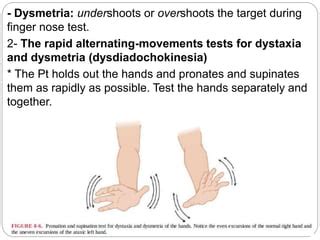 Dysmetria: What Is It, Causes, Diagnosis, Treatment, And, 46% OFF