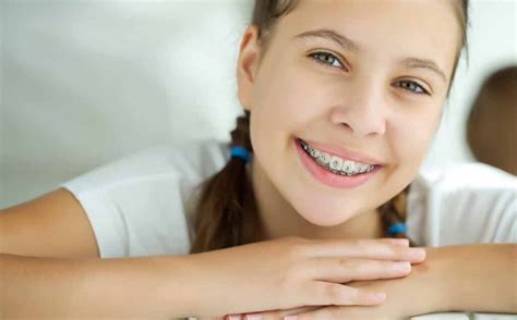 Orthodontics Australia | Ceramic braces for kids & teens