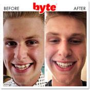 Byte Before & After Photos: Pics of Real Customer Results