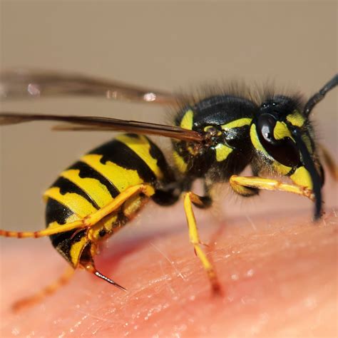 Wasp Sting: Symptoms, Treatments and Remedies – General Health Magazine