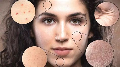 The Ultimate Guide to Common Skin Problems and Effective Treatments