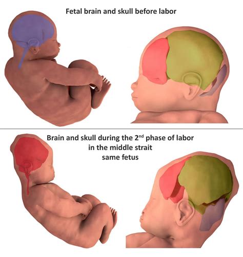 3D images reveal how infants' heads change shape during birth ...