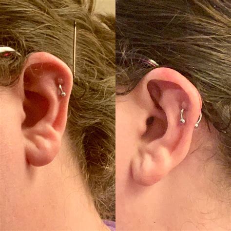 Constant keloids & 10 months healing for helix : r/piercing