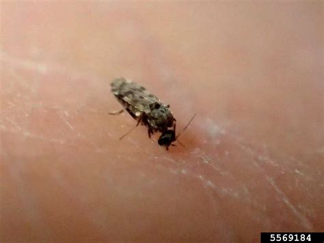 Tiny Flying Bugs In My House That Bite | Psoriasisguru.com