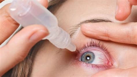 Conjunctivitis: Simple home remedies to treat the eye condition | Hindustan Times