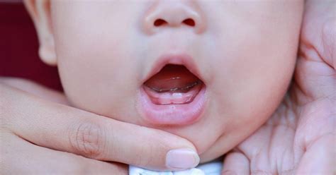 Baby Teething: Signs, Symptoms, Remedies, and FAQs - St. Johns Pediatric Dentistry