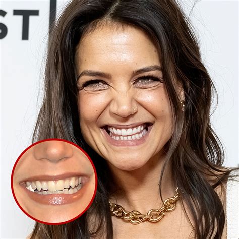 21 Celebrity Dental Implants And Veneers: Before And After - SHEfinds