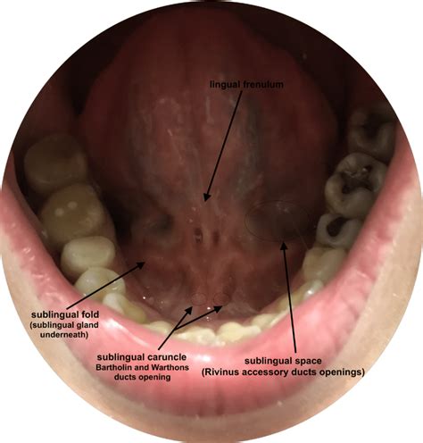 Mouth Floor Anatomy | Viewfloor.co