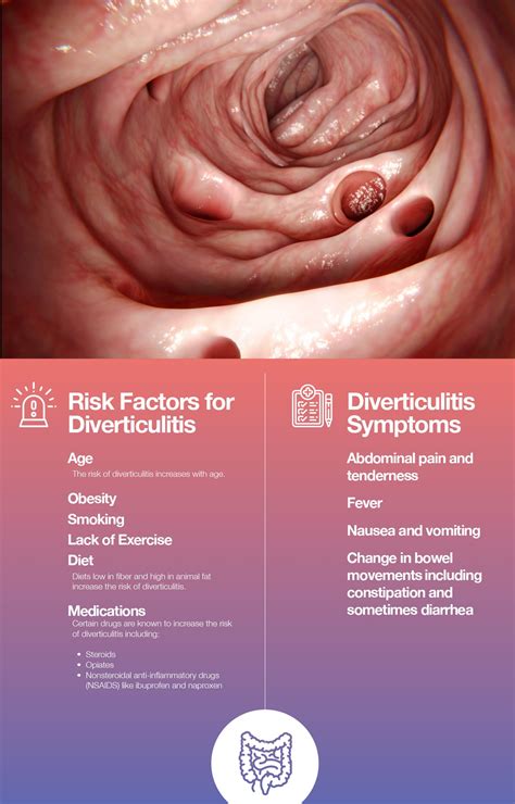 Diverticulitis Surgery