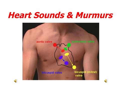 Heart Sounds And Murmurs | Heart sounds, Physiology, Nursing mnemonics