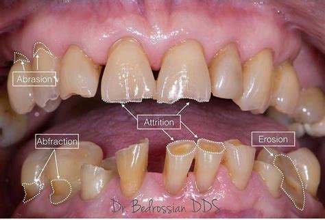 Gv Health Dental - Doctor Heck