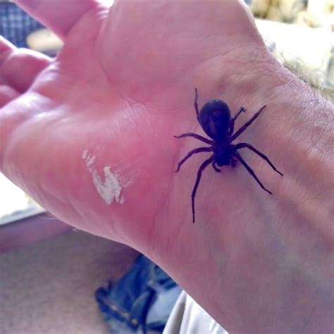 Black Widow Spider Bite Pictures - pic-nugget