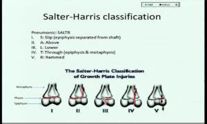 salter_harris_classification - Charlie's ED