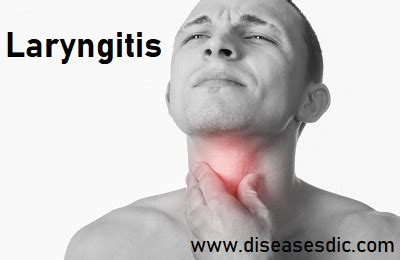 Laryngitis - Causes, Symptoms, Treatment, and Prevention.