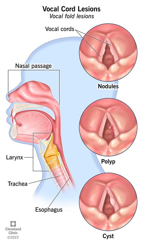 Vocal Cords Anatomy