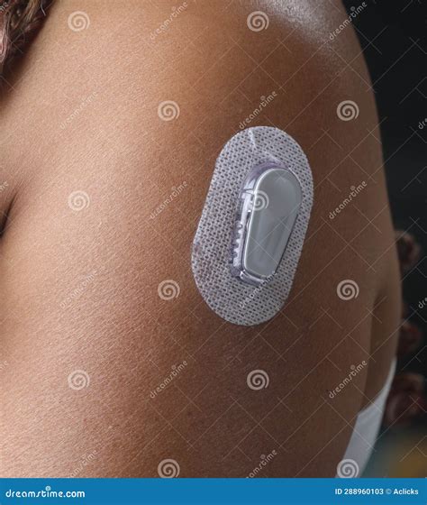 Woman Testing Glucose Level with a Continuous Glucose Monitor on Her Arm Stock Image - Image of ...