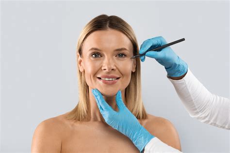 What to Expect After a SMAS Facelift | Douglas S. Steinbrech, MD