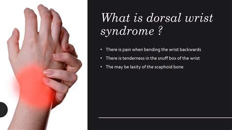 Dorsal Wrist Syndrome Diagnosis and Treatment - Dr Anzarut Plastic Surgery