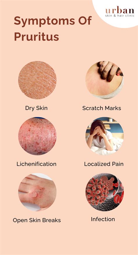 Pruritus Types, Causes, Symptoms & Treatment | USHC