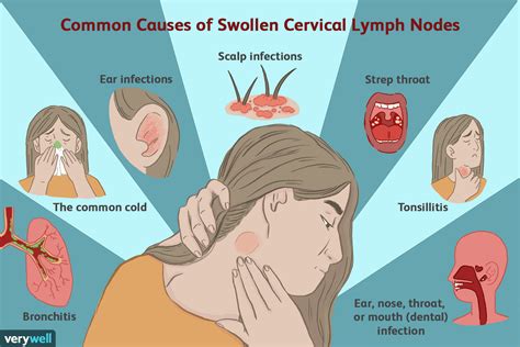 Swollen Lymph Nodes Behind Ear Children