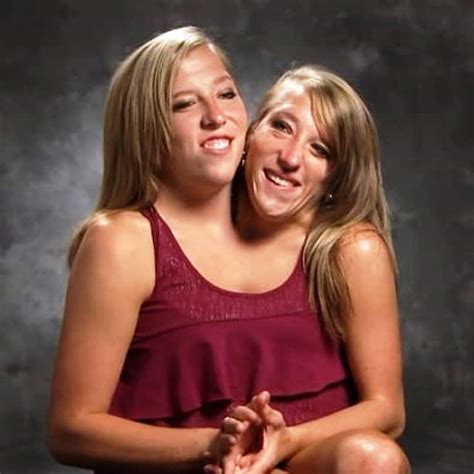 Abby and brittany hensel conjoined twins engaged - pnafile