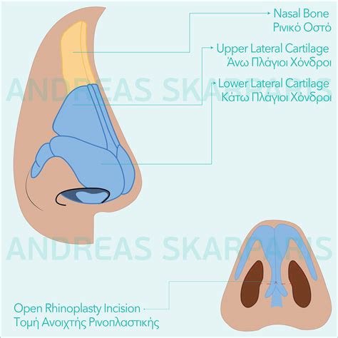 Nose Reshaping – Dr.Andreas Skarparis