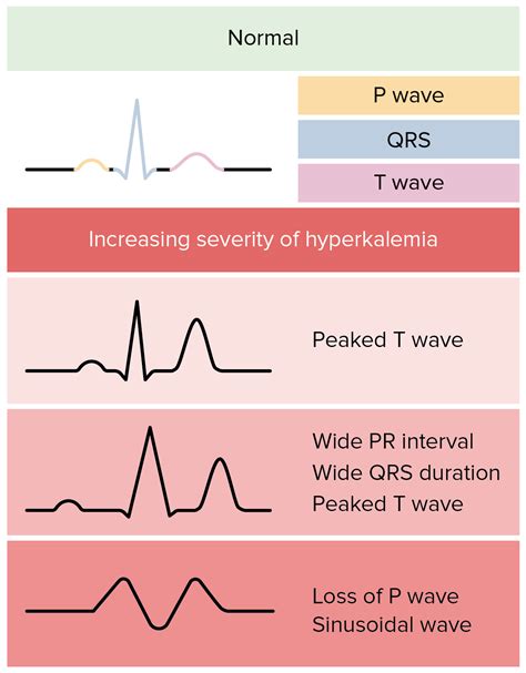 Hyperkalemia Ekg