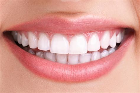 Teeth Whitening - Smile Dental Care