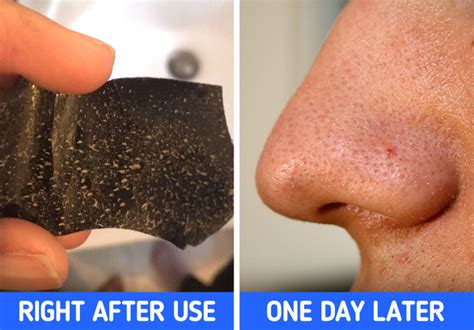 6 Things You Need to Know Before Using Pore Strips / Bright Side