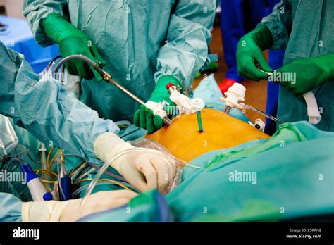 Liver surgery hi-res stock photography and images - Alamy