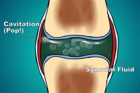 Clicking Knees: Symptoms, Causes, Treatment By Clicking Knees