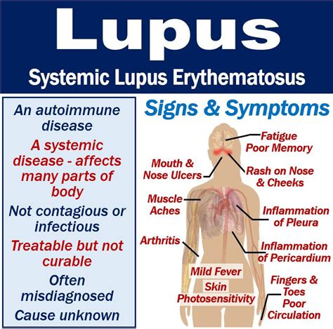 What is lupus? Symptoms, causes, diagnosis, and treatment - MBN Health