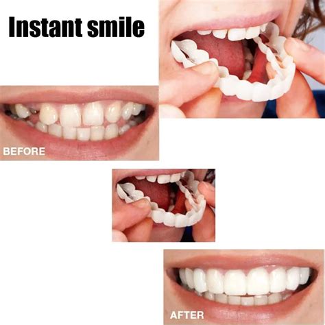 Instant Perfect Smile Upper & Lower Clip/Snap On Veneers for Perfect T ...