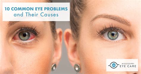 10 Common Eye Problems and Their Causes - Mississippi Eye Care