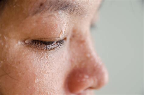 What Causes Skin Pallor and Sweating?