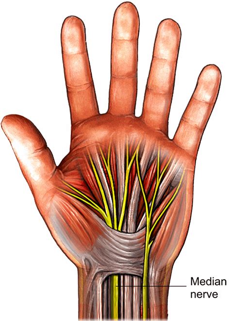 Carpal tunnel release | healthdirect