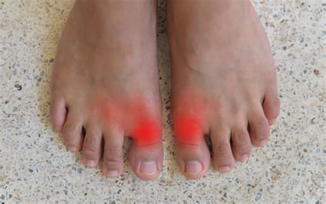 Common Causes of Big Toe Joint Pain - The Foot Clinic | Cottesloe