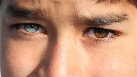 Beautiful Eyes Color, Pretty Eyes, Heterochromia Eyes, Two Different ...