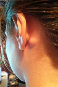 Swollen lymph nodes behind ear - lightingloki