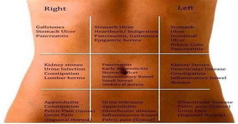 Abdominal and Stomach Pain Map: Understand Your Gut Pain