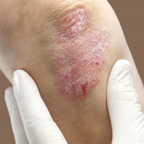 Types Of Skin Problems Types Of Skin Conditions Pictures Photos | Images and Photos finder