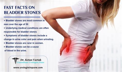 What is Bladder Stone and It's Symptoms? - Dr. Ketan Vartak