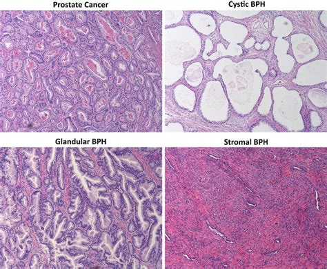 Representative images of H&E stained histology (same magnification ...