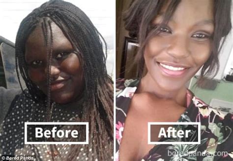 Transformations show what weight loss does to the face [PICS ...