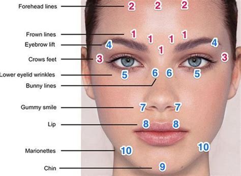 Botox Eyebrow Lift Injection Sites eyebrows, plastic surgery - | Tıbbi, Cilt bakımı, Dudak